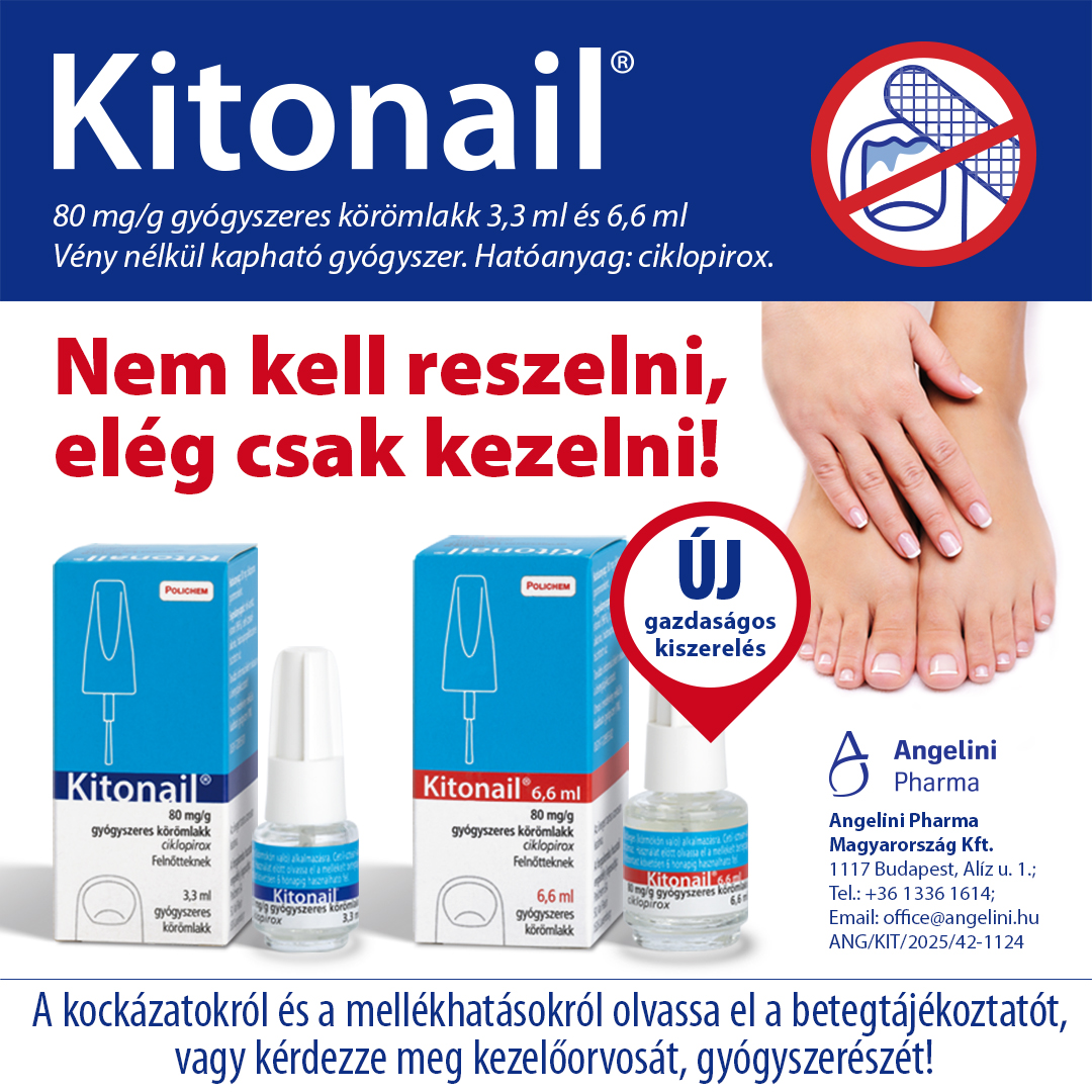 Mi is az a körömgomba és hogyan lehet felismerni? Mi is az a körömgomba és hogyan lehet felismerni?