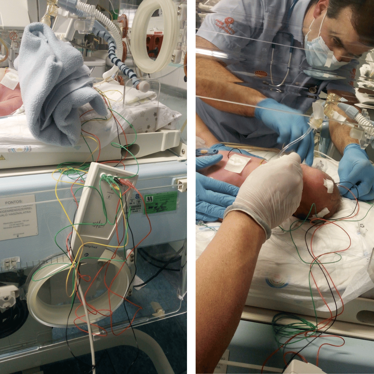 Kulcs adományból koraszülöttmentő készülék 