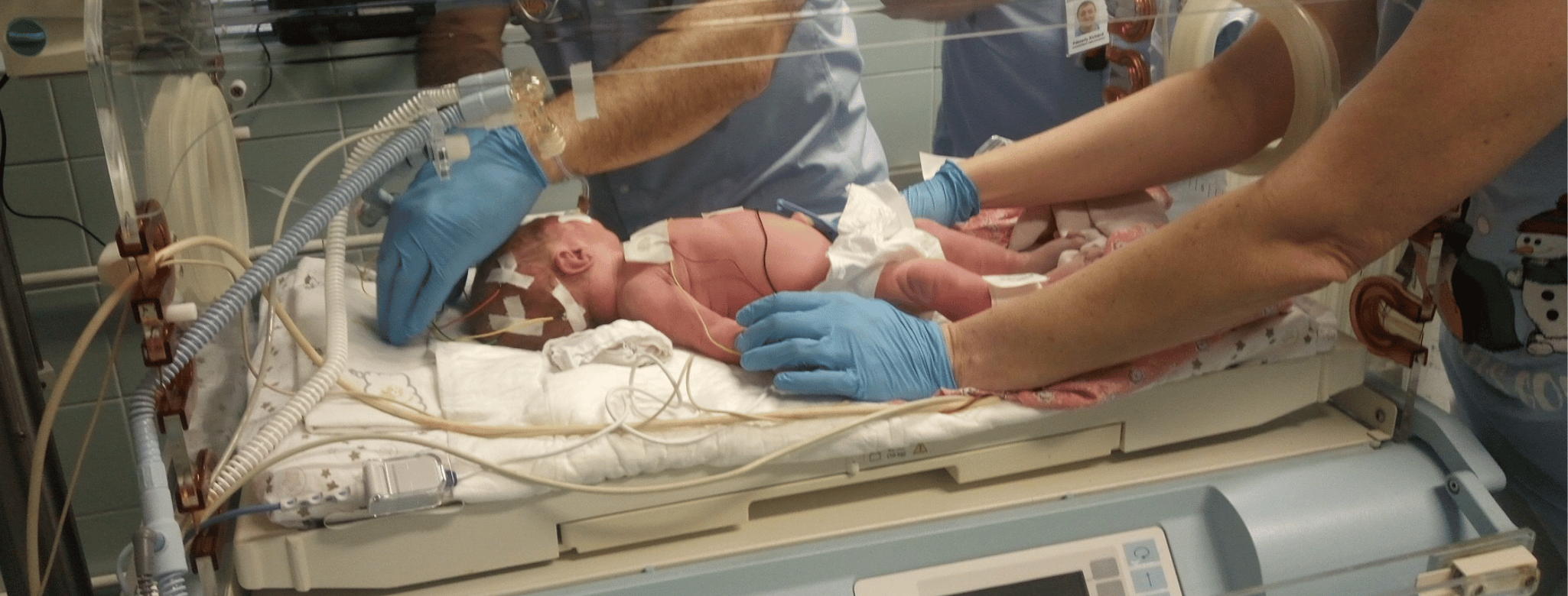 Kulcs adományból koraszülöttmentő készülék 