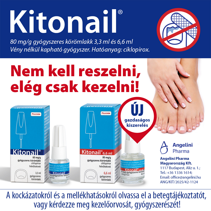 Mi is az a körömgomba és hogyan lehet felismerni? 