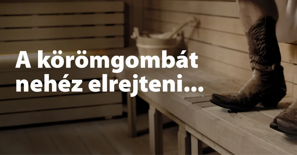 Mi is az a körömgomba és hogyan lehet felismerni?