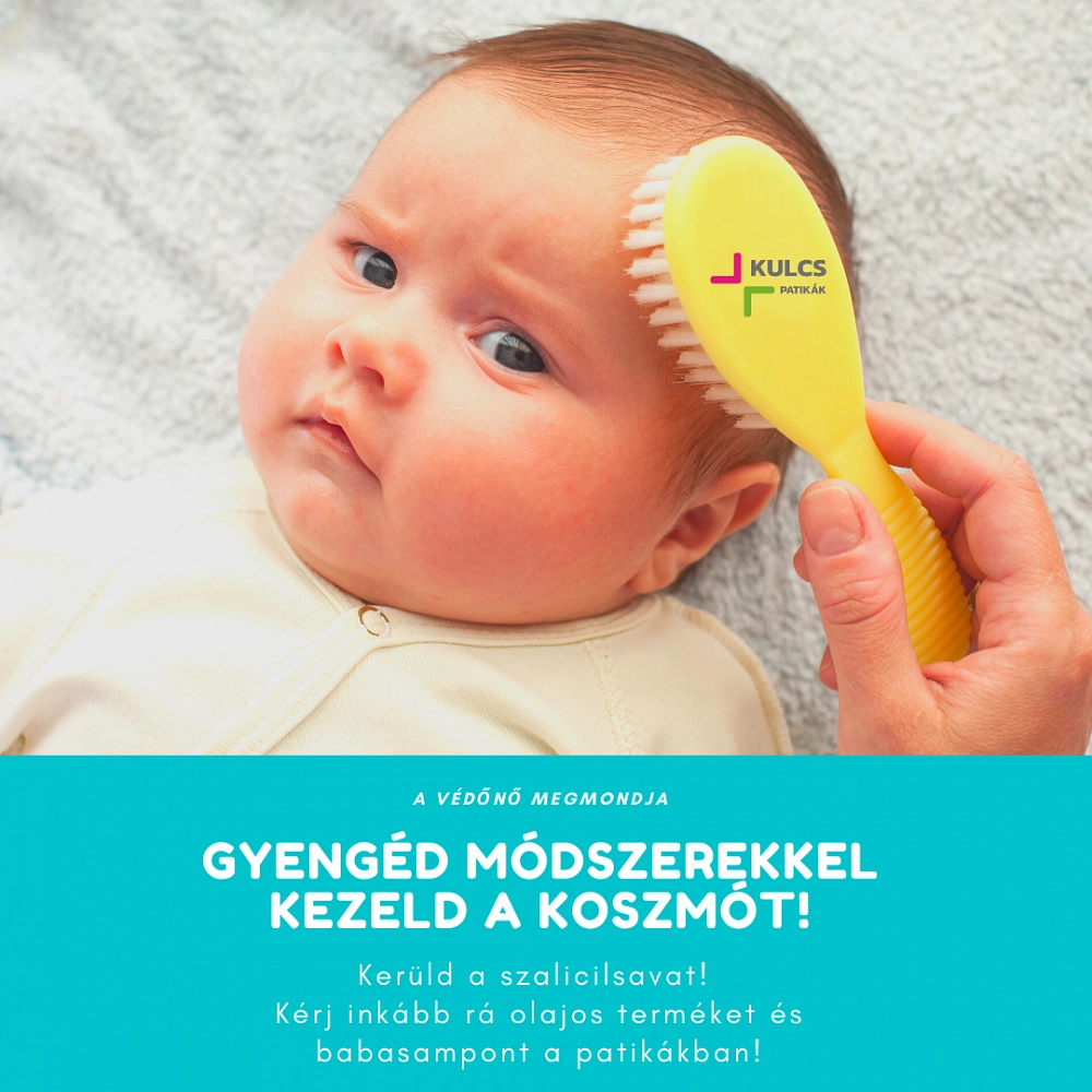 Olajokkal vagy tisztítókendőkkel is ápolni tudjuk a baba fejbőrét 