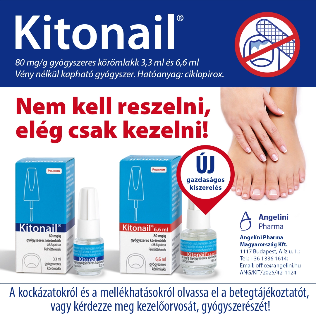 Mi is az a körömgomba és hogyan lehet felismerni? Mi is az a körömgomba és hogyan lehet felismerni?