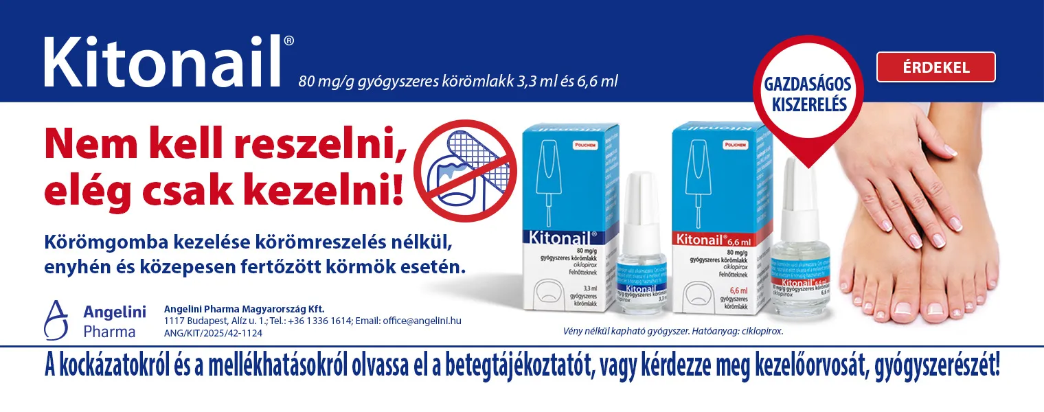 Kitonail-szep